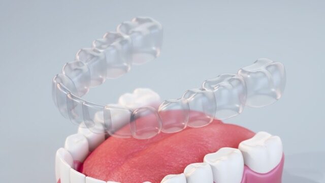 Invisalign Process at Chandler Dentistry