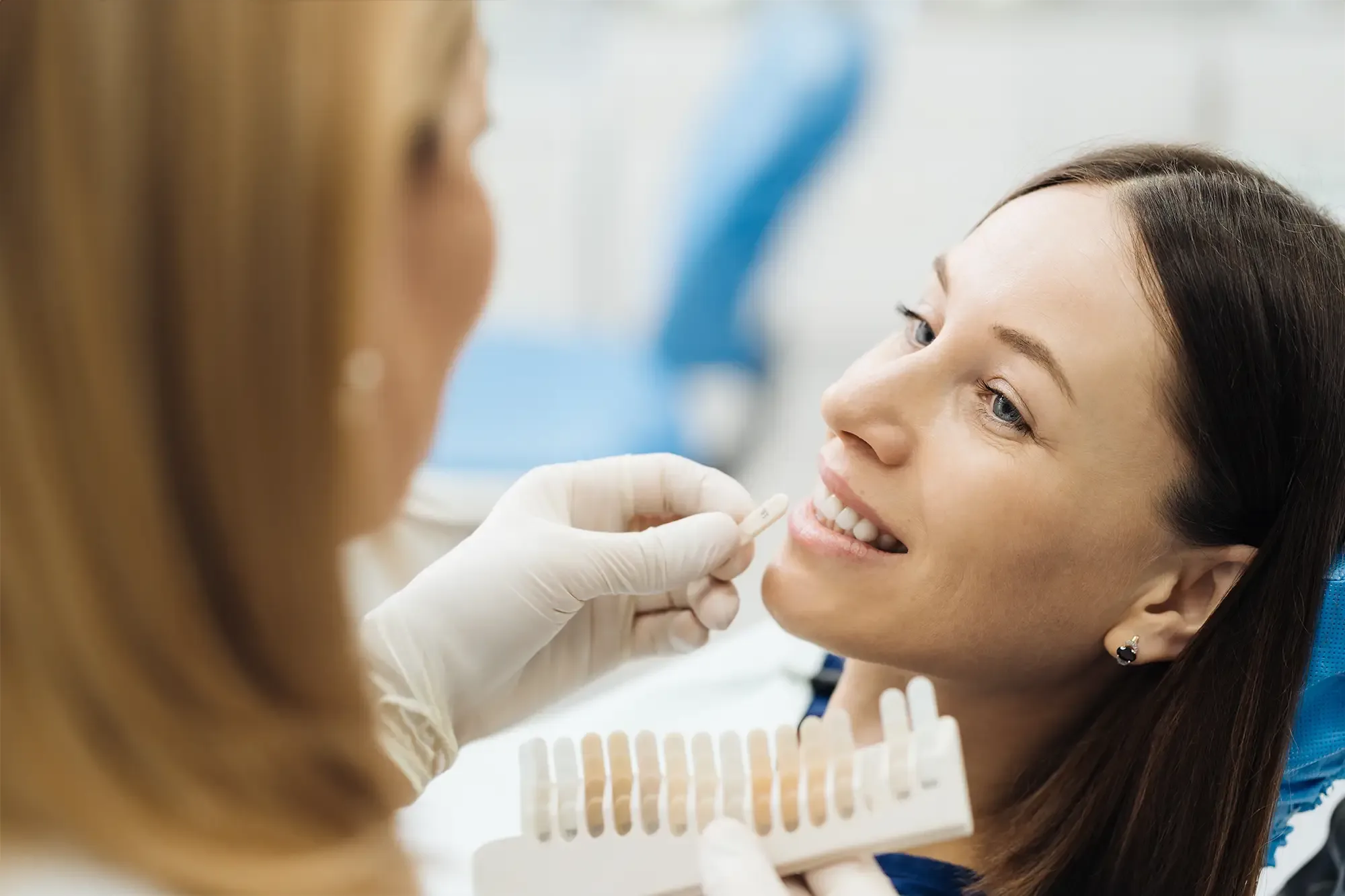 Veneers Process Chandler AZ